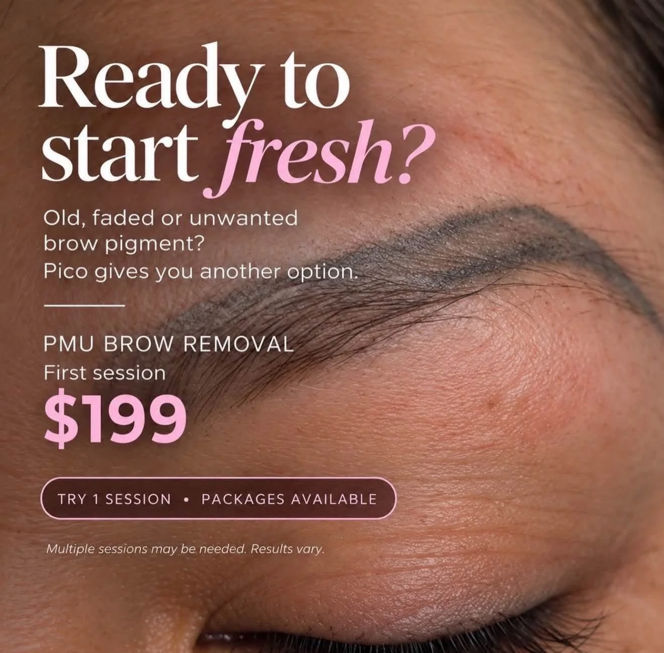 🚨 STILL STUCK WITH OLD BROWS OR A TATTOO YOU REGRET? 👀

Let&rsquo;s fade it with Pico Laser Removal ⚡
✨ PMU Brow Removal
✨ Small Tattoo Removal &mdash; first session $199!
📍 VIVID BEAUTY CLINIC | Northglenn, CO
🗣️ Hablamos espa&ntilde;ol

Message