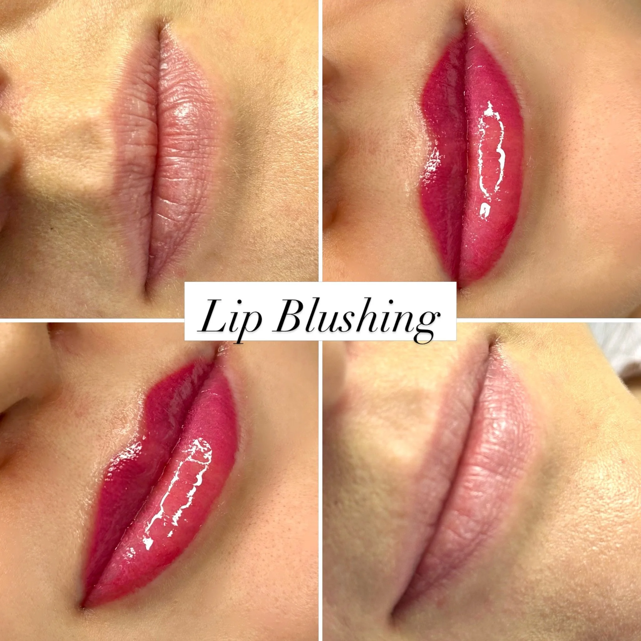 💋 PRETTY IN PINK&hellip; BUT MAKE IT PERMANENT! 🩷✨

Can we take a moment to appreciate these BEAUTIFUL lips?! 😍

Today we created the prettiest plush pink Lip Blush, giving these lips a soft, youthful, naturally enhanced appearance! 💕

💄 Did you