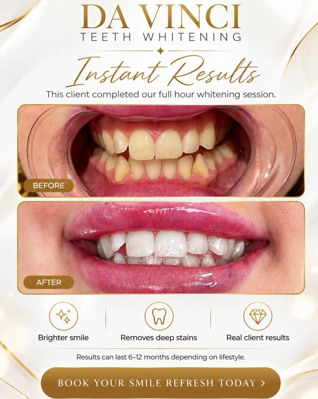 ✨🦷 HOLIDAY-READY SMILE? YES, PLEASE! 😍🎄

The holidays are coming, and nothing completes your look like a BRIGHT, CONFIDENT SMILE! 🤍✨

☕ Coffee, tea, and everyday habits can leave stubborn stains that regular brushing just can&rsquo;t remove!

Our