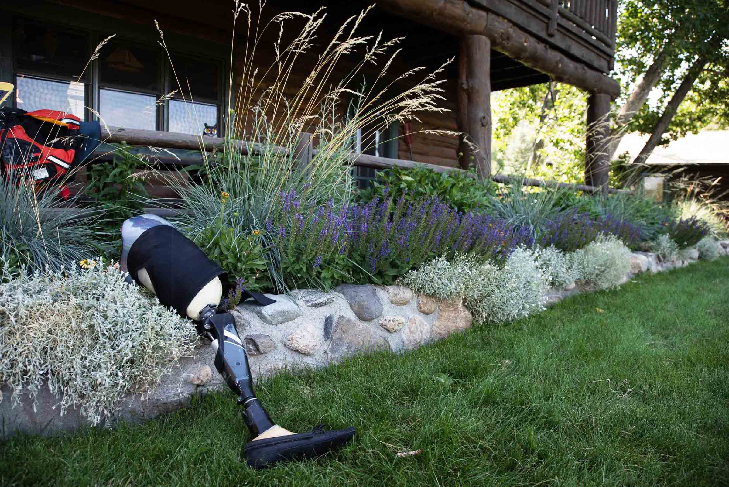 prosthetic leg laid in garden at trr outtasight clinic.jpg