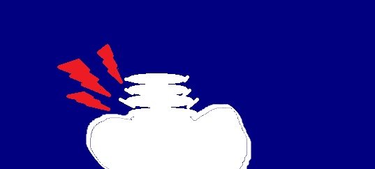 Emotional Healing Spondylosis Reiki pic..jpg
