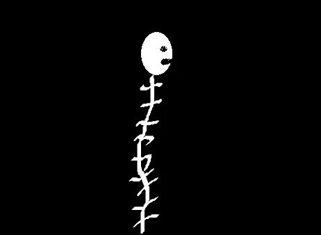 spondylearthrosis pic.jpg