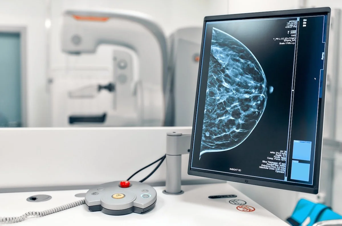 Breast Cancer Awareness Month: Dense Breasts, 3D Mammograms, and When to Add Ultrasound