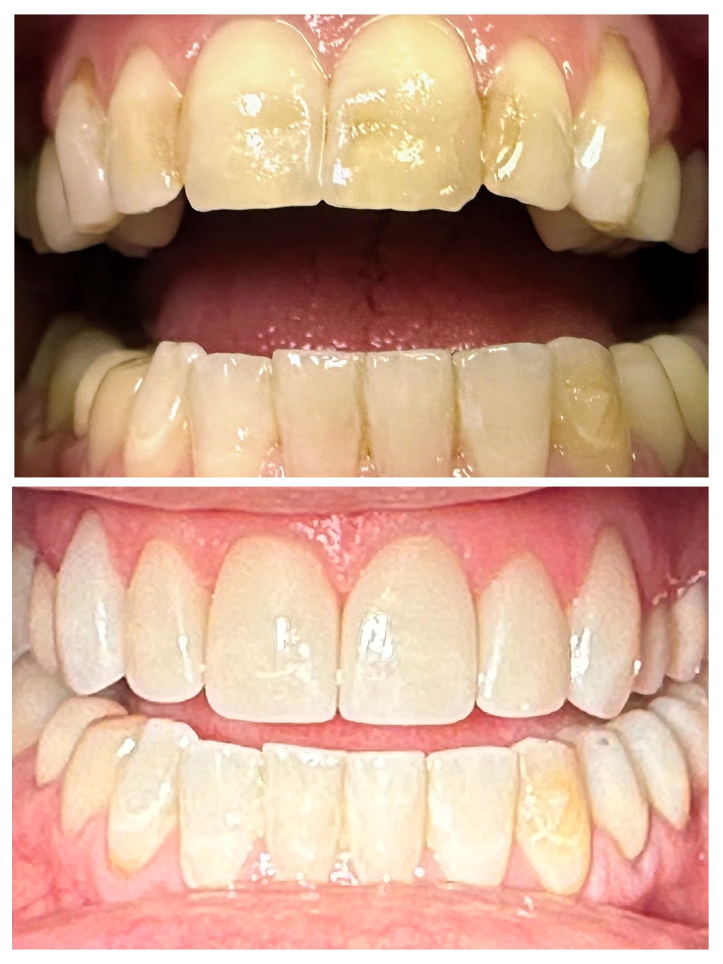 ED98BDDC-831D-4B21-95C2-E24712CA6991-COLLAGE.jpg