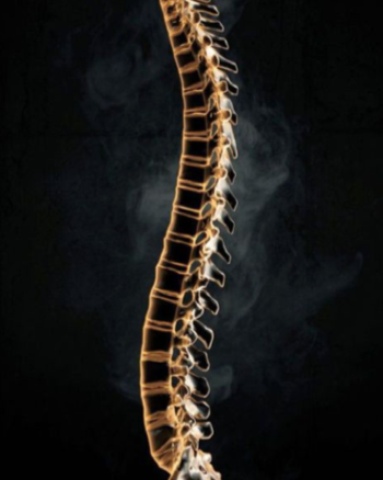 An X-ray image of a human spine against a dark background.