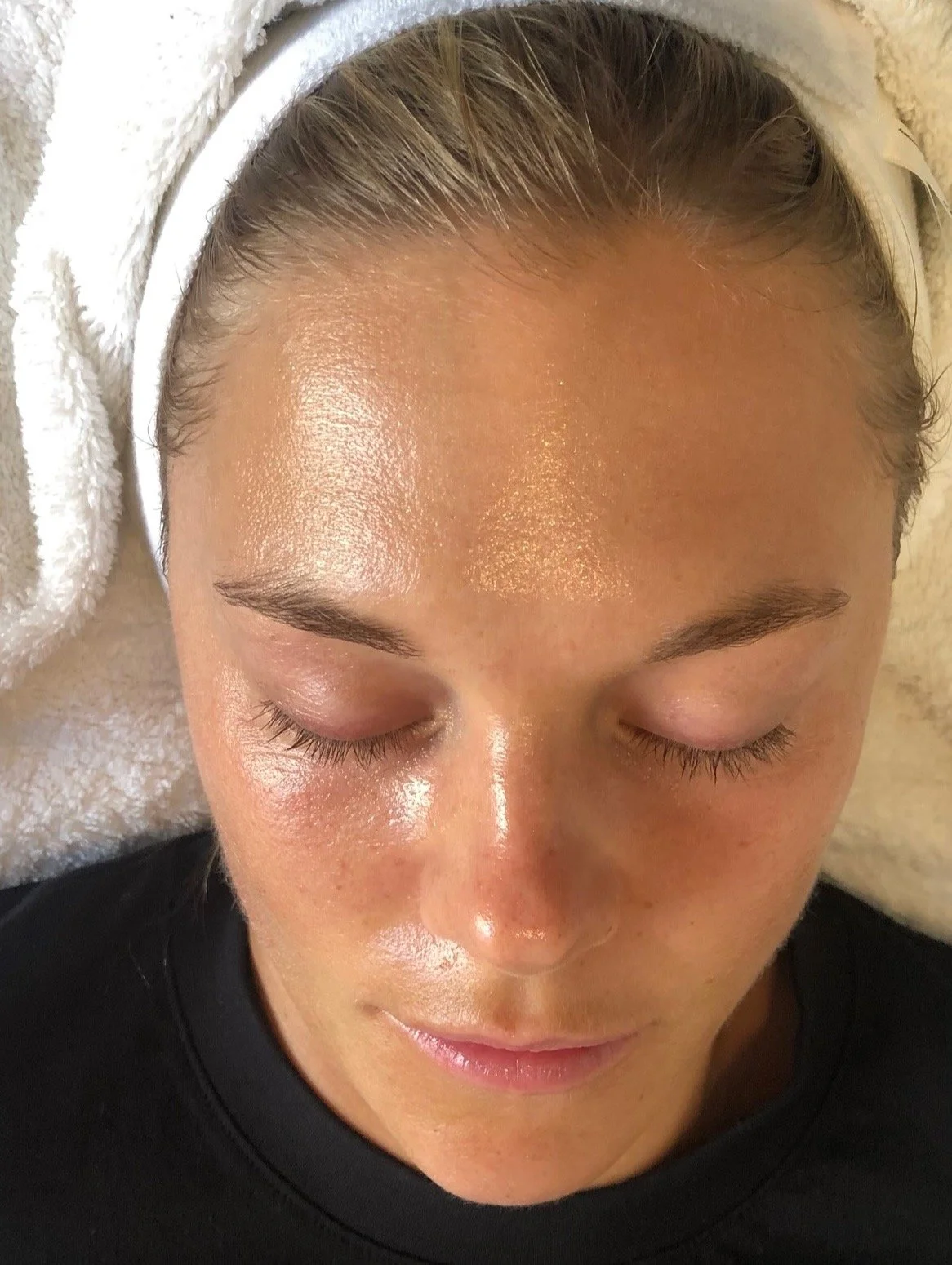 Efter vintern k&auml;nns huden ofta torr, k&auml;nslig och i obalans.

Dermadrop arbetar p&aring; djupet i huden och hj&auml;lper till att &aring;terfukta, lugna och ge ny lyster. 

Under april erbjuder vi behandlingen f&ouml;r 1295 kr (ord. 2500 kr)