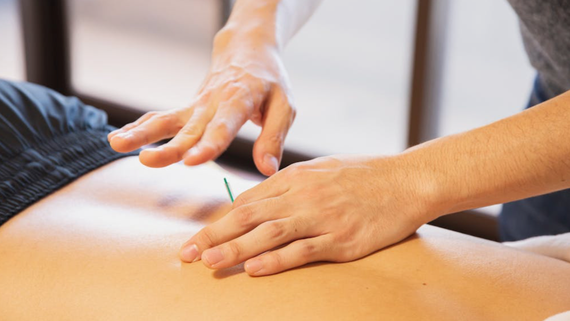 Warum Dry Needling die Ursache deiner Schmerzen nicht löst