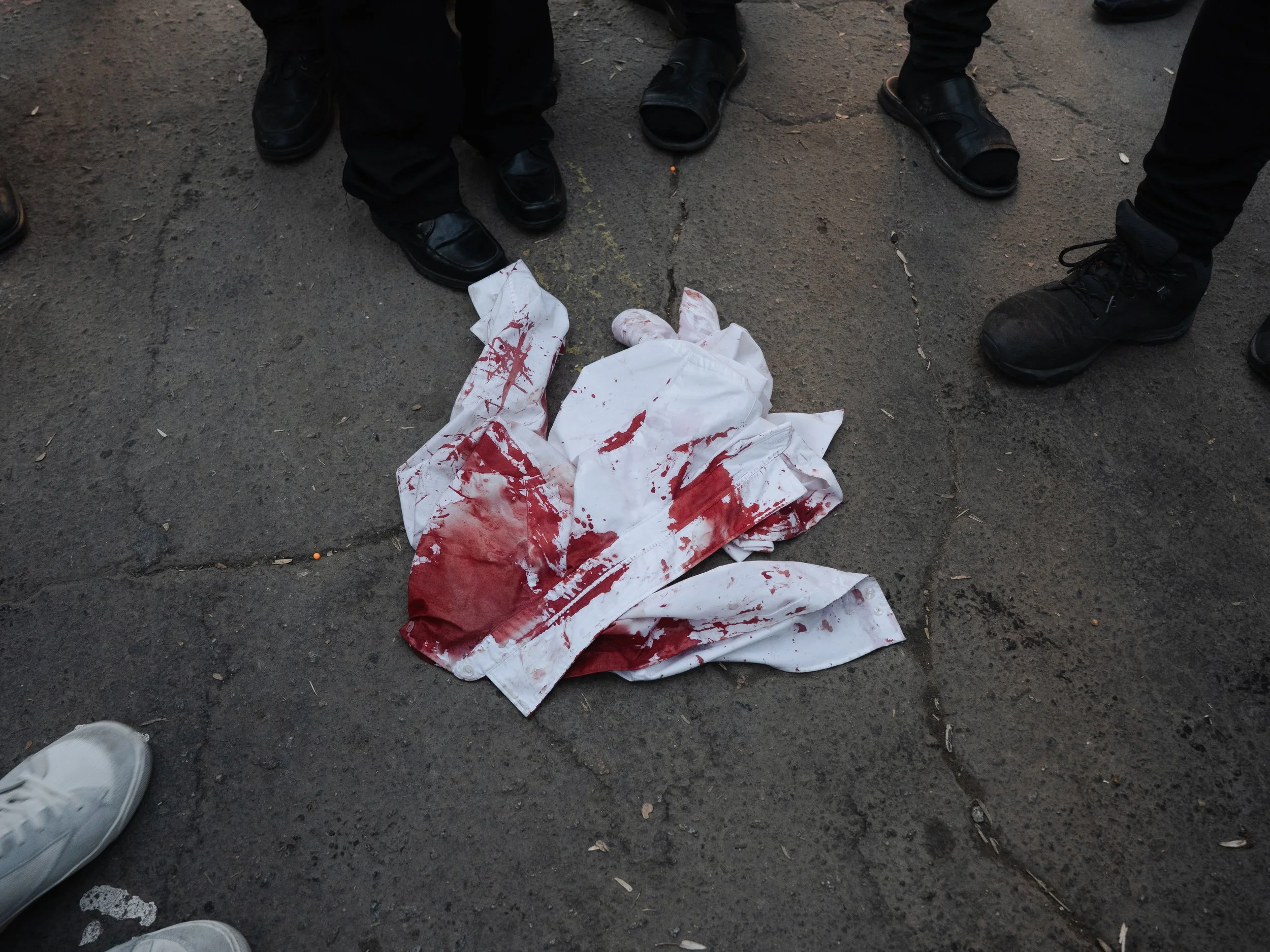 Blood-stained white cloth lying on cracked asphalt with group of shoes surrounding it.