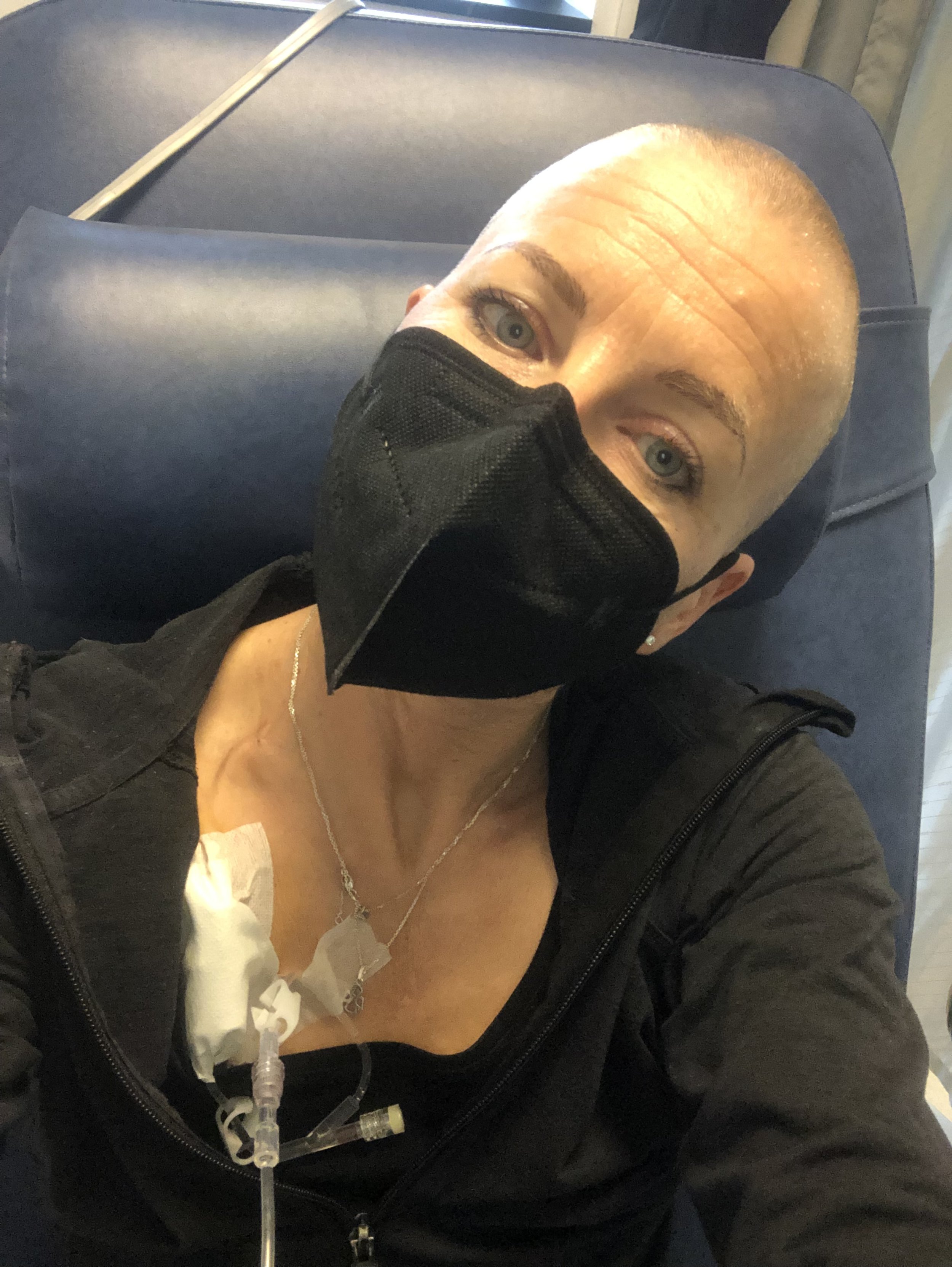 My chemo side effects. And top tips for managing them.