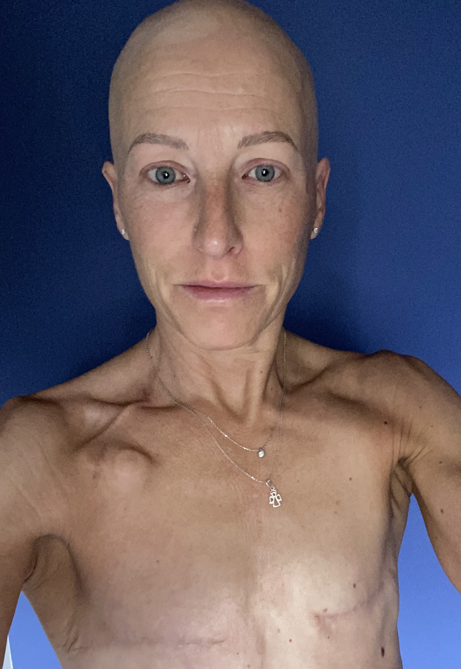 How to - and what - to eat during chemo.