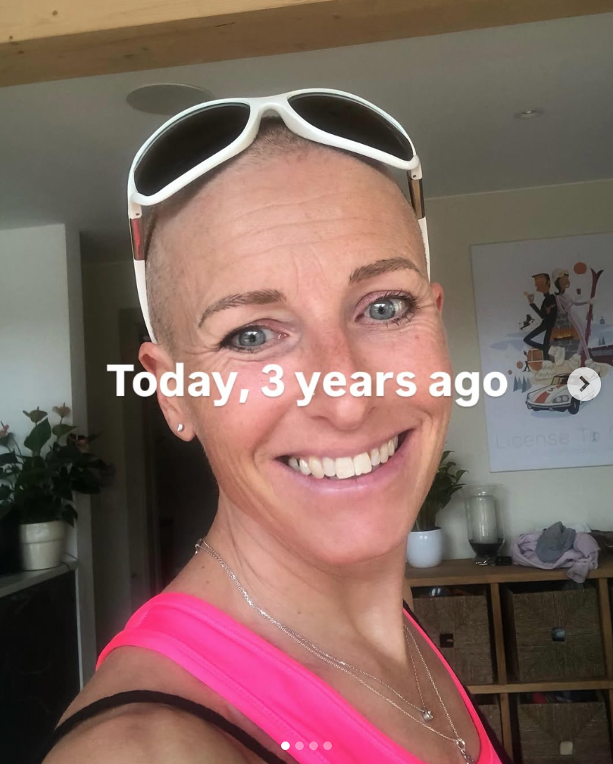 Why it’s not ‘just’ hair. How the little things can help cancer patients feel normal 