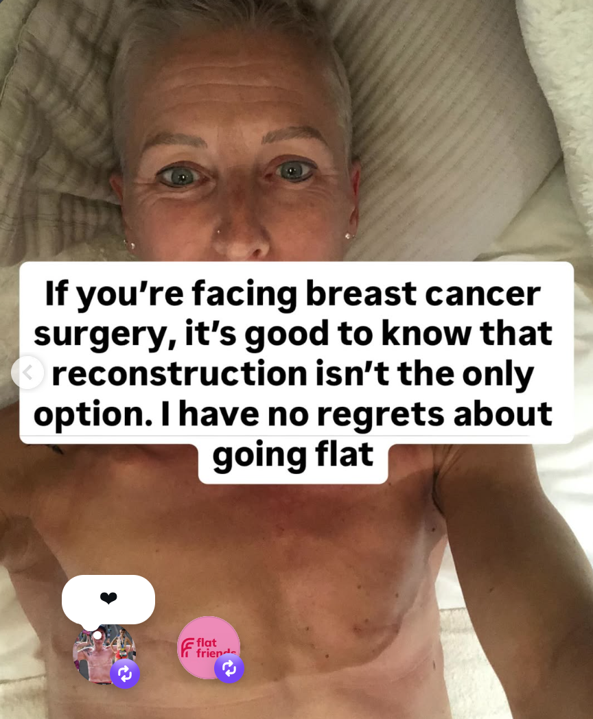 Reconstruction is not the only option after breast cancer
