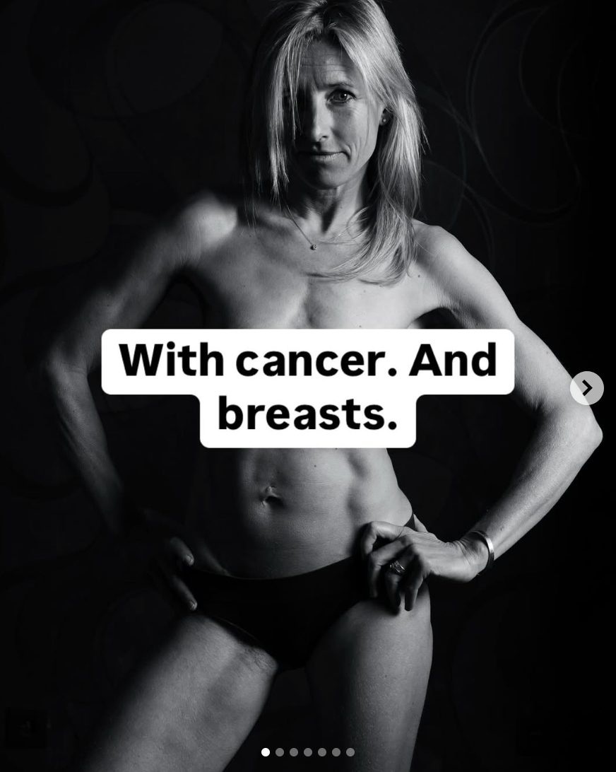 The last photos of me with breasts, before cancer and a double mastectomy