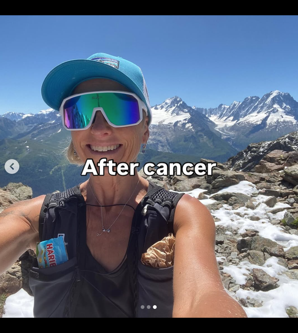 After cancer, I have redefined my relationship with my body and my femininity