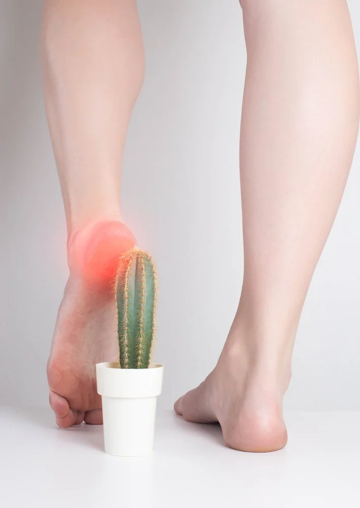Research looking at acupuncture treating diabetic peripheral neuropathy.