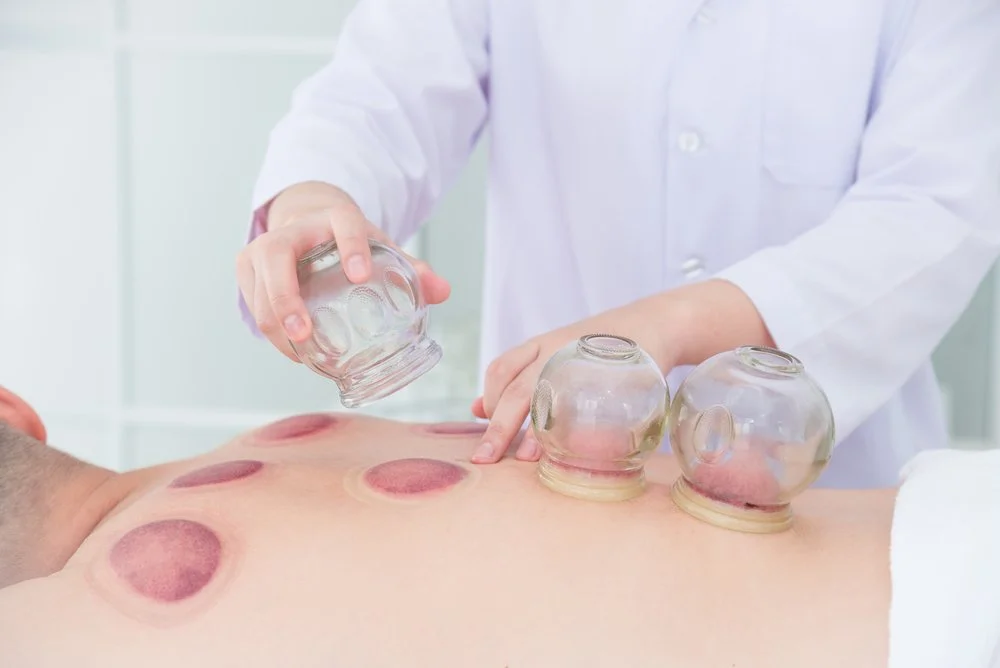 Cupping shown to enhance muscle activity in those with chronic lower back pain.