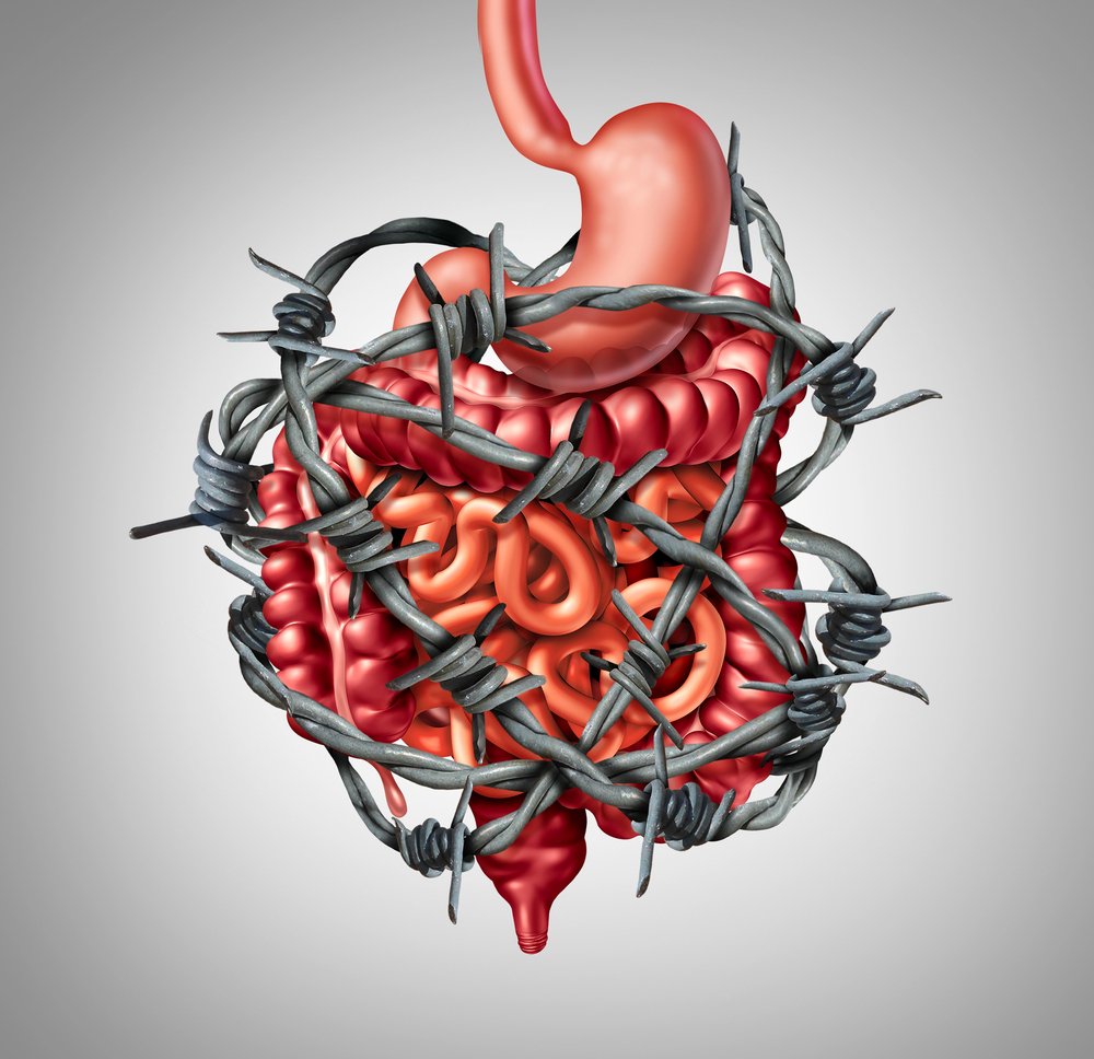 Research looking at efficacy of acupuncture on treating IBS.