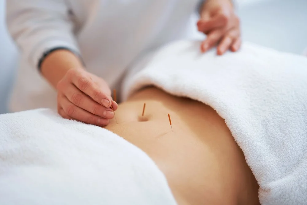 Study looking at how acupuncture helps with PCOS (poly-cystic ovarian syndrome).
