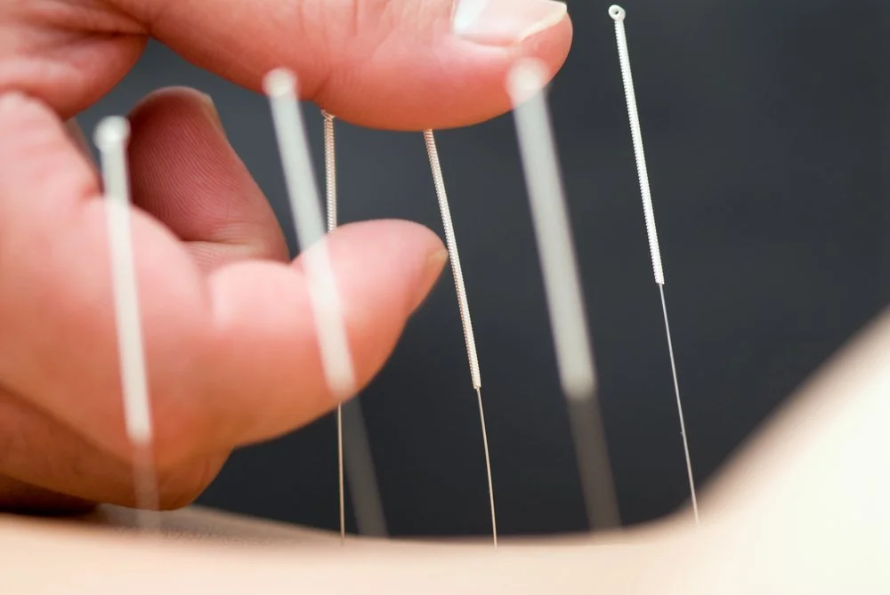 Research show that acupuncture has anti-inflammatory effects on multiple organ systems in the body. 