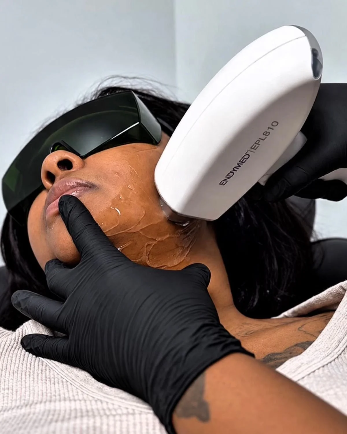 Woman receiving facial laser hair removal treatment at The Lush Look in Englewood, Ohio.