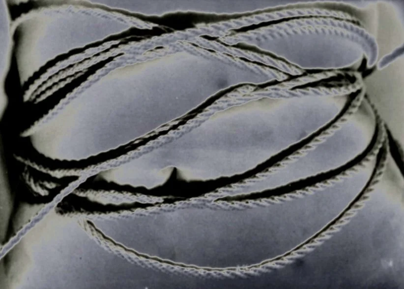 What the Rope Leaves - Solarized Flesh (Compression Study II)