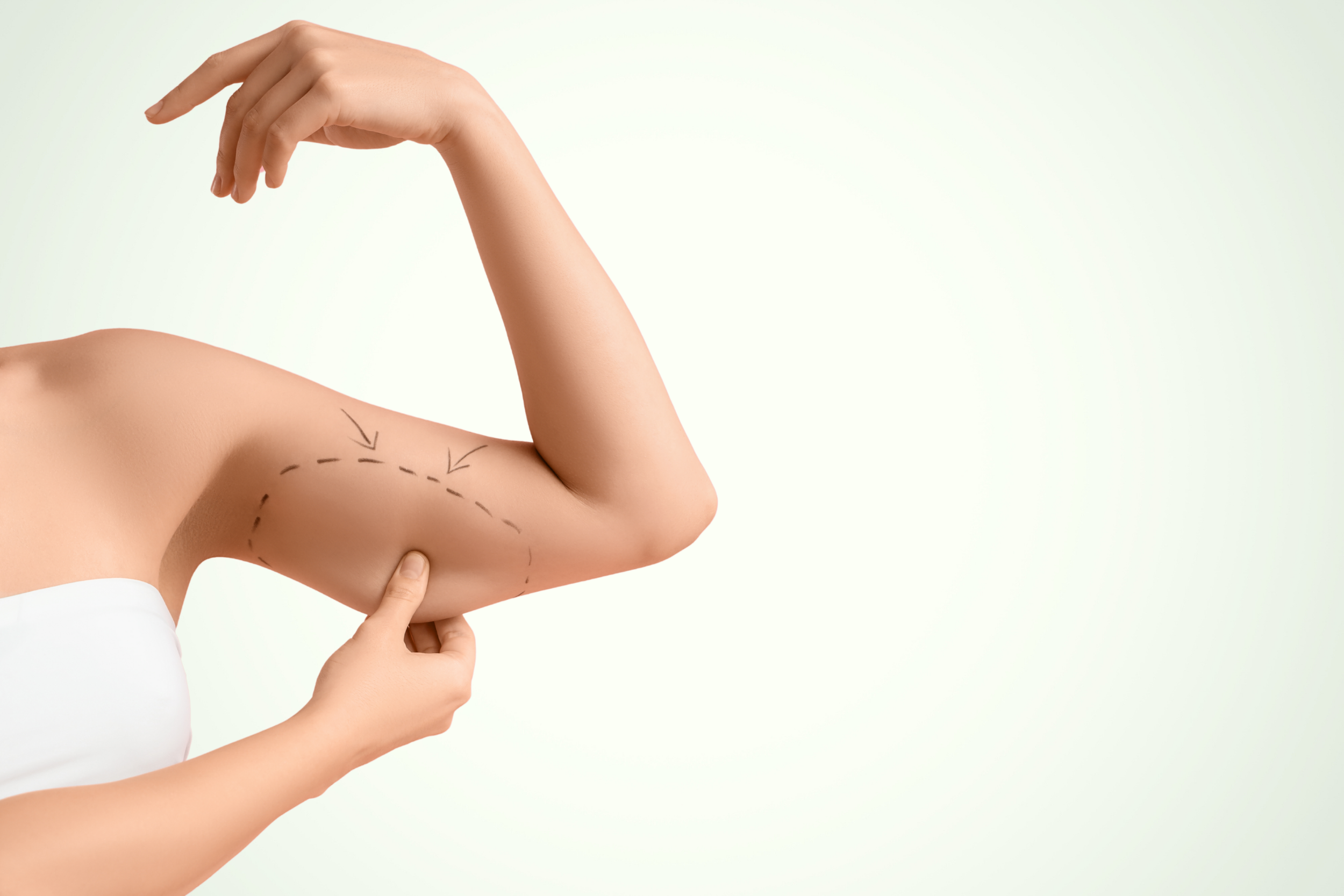 Arm lift and Thigh lift with American Board Certified Expertise