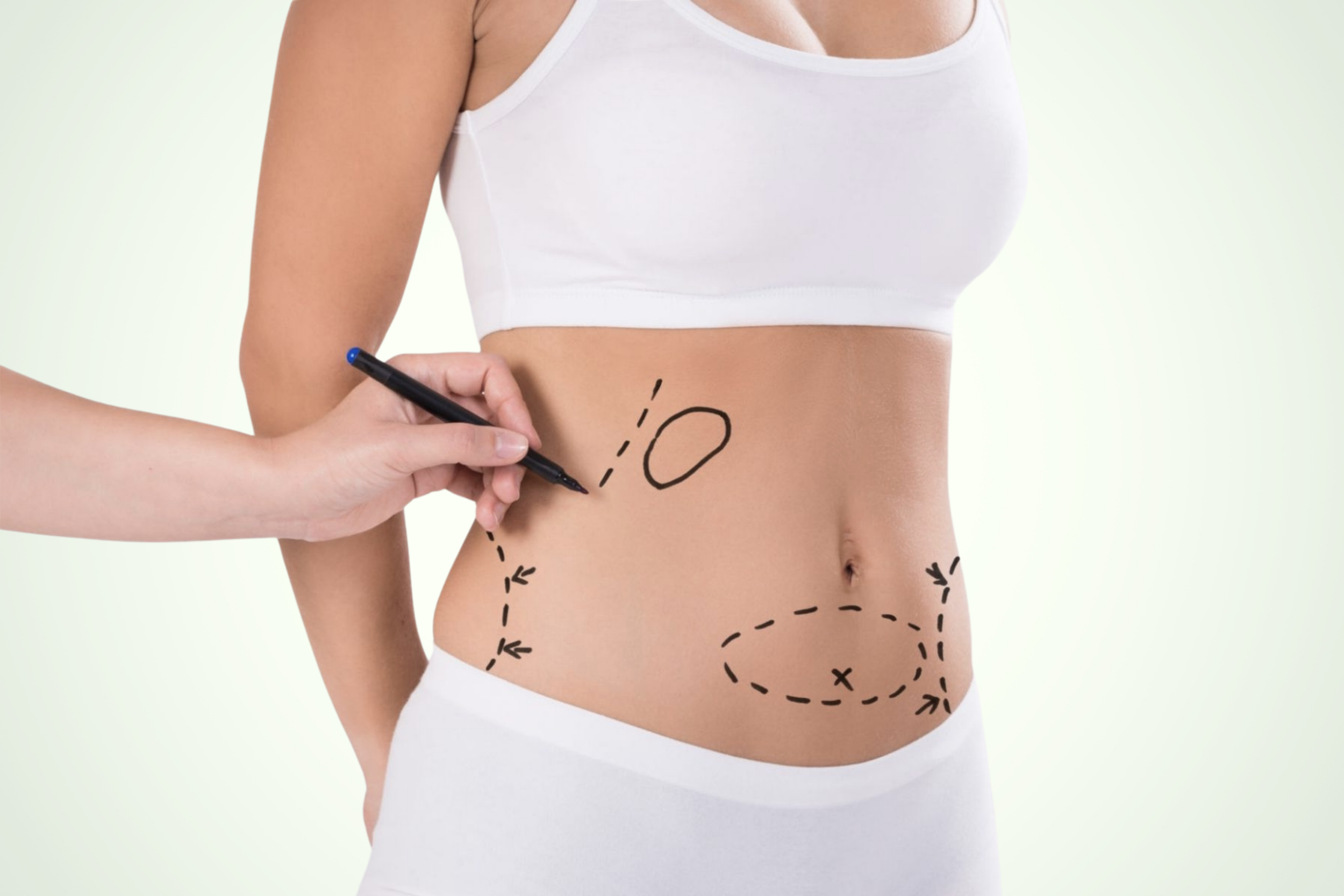Liposuction body contouring surgery Dubai