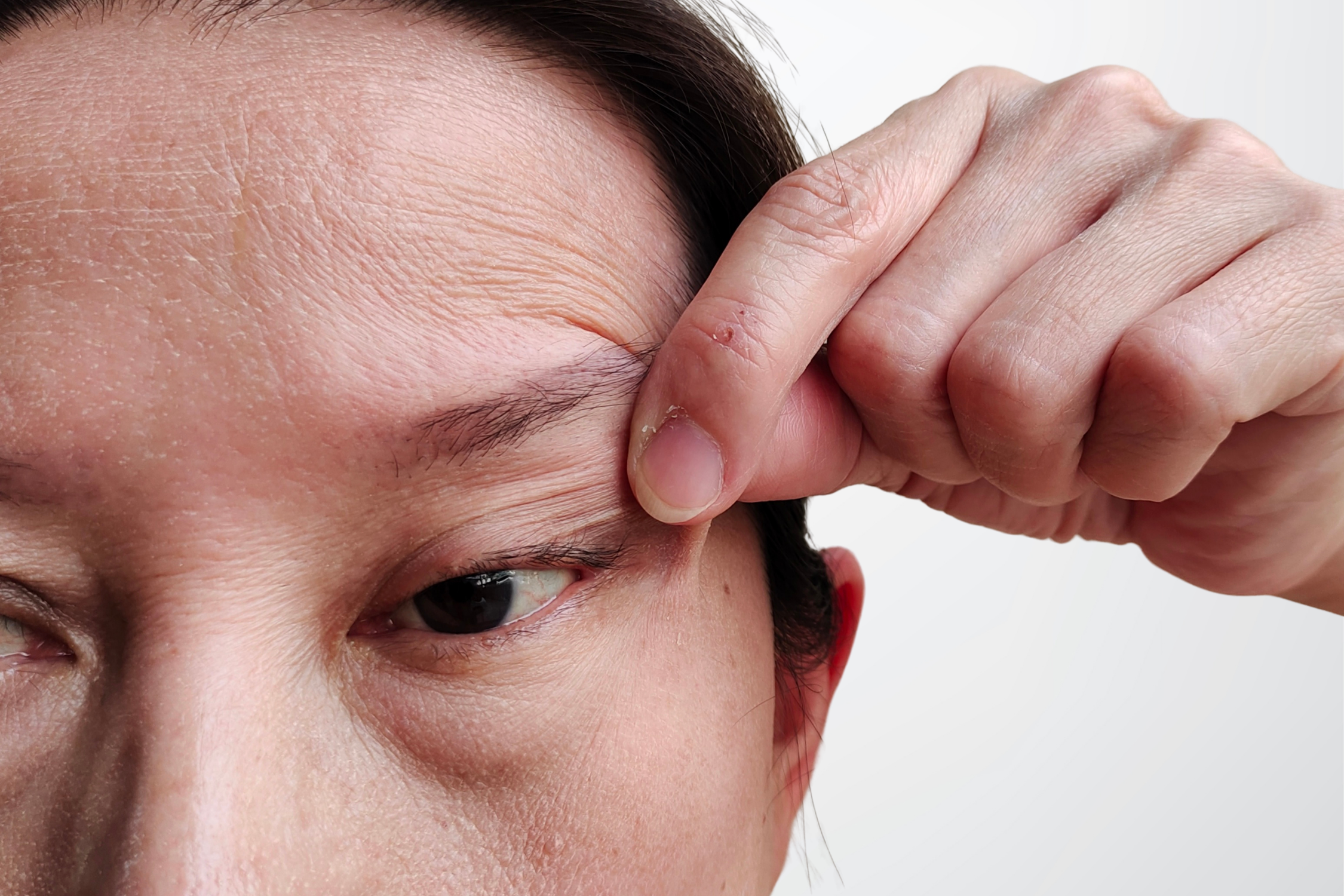 Eyelid surgery consultation aesthetic clinic Dubai