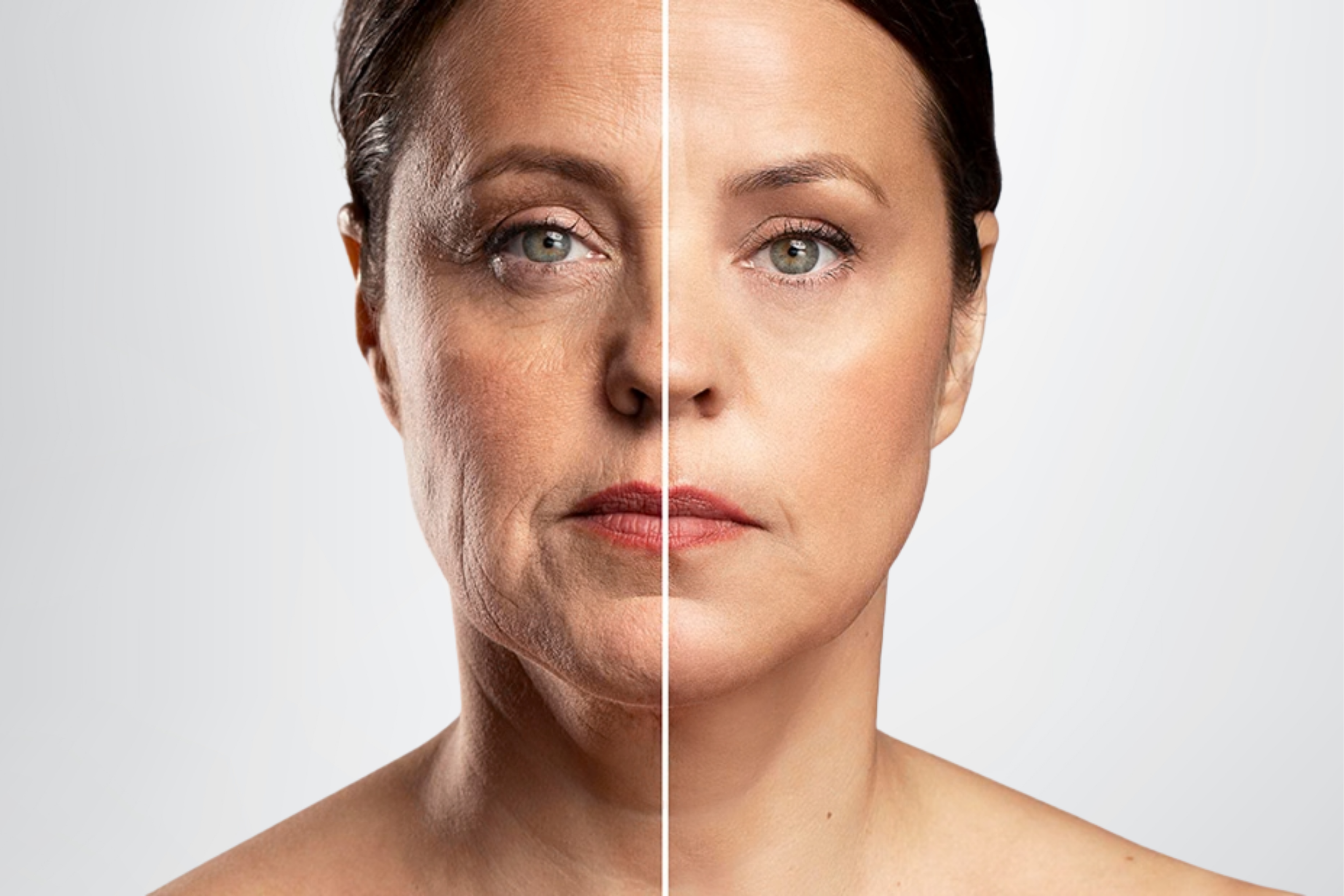 clear transformation to a more younger look after Stem Cell Therapy.