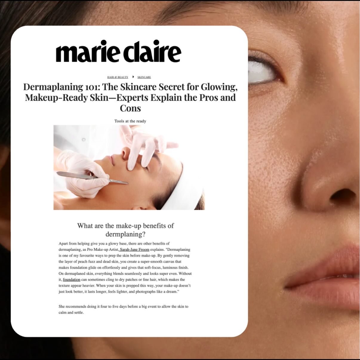 Demanding 101:
SJ Froom on why dermaplaning is the prep your makeup actually loves as featured in Marie Claire! @sarahjanefroom 

Thank you @katie_thomas_hayne @marieclaireuk