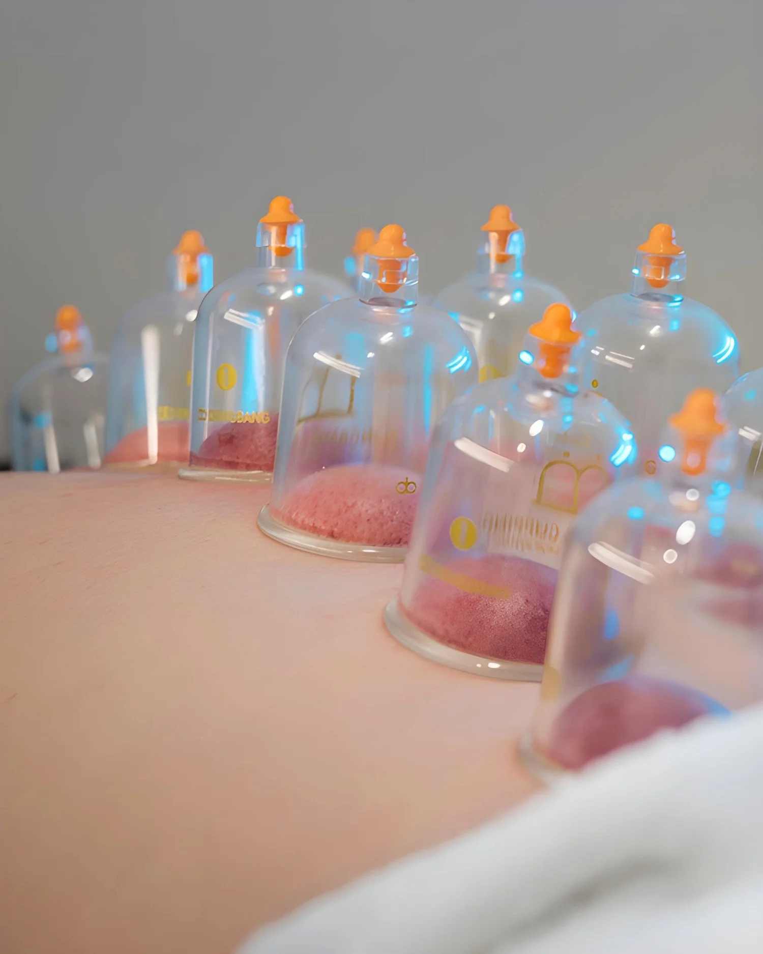 30-minute chiropractic visit with cupping therapy at Optimum Health in Inver Grove Heights