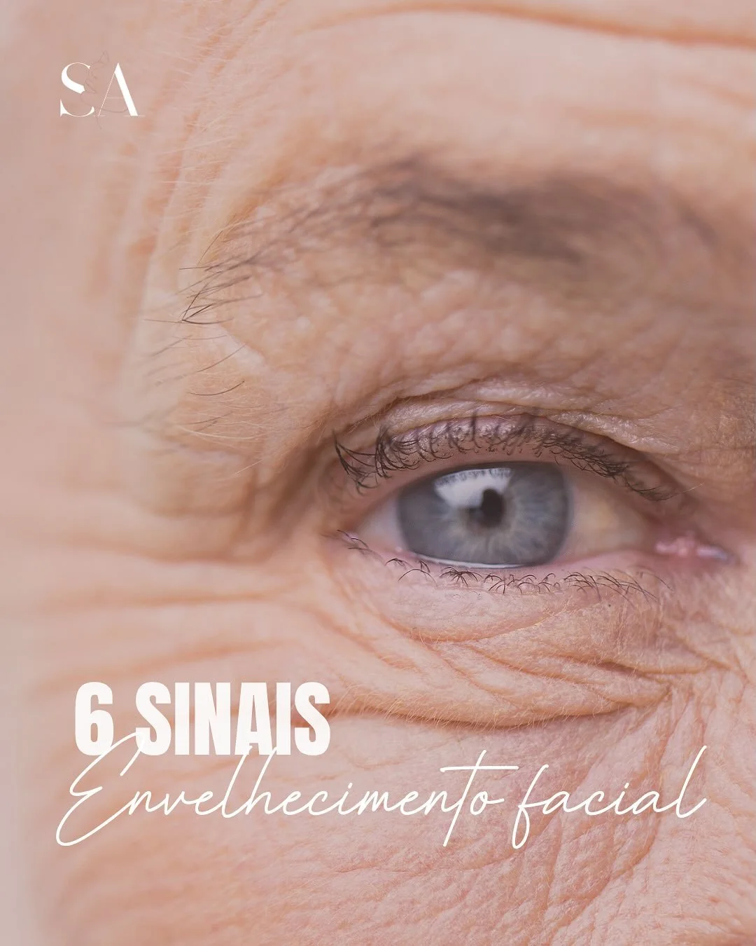 Por volta dos 25-30 anos começam a aparecer os 𝙥𝙧𝙞𝙢𝙚𝙞𝙧𝙤𝙨 𝙨𝙞𝙣𝙖𝙞𝙨 𝙙𝙚 𝙚𝙣𝙫𝙚𝙡𝙝𝙚𝙘𝙞𝙢𝙚𝙣𝙩𝙤 da pele, os quais vão agravando ao longo do tempo! ⏳
Quanto mais cedo começarmos a prevení-los, menos impact