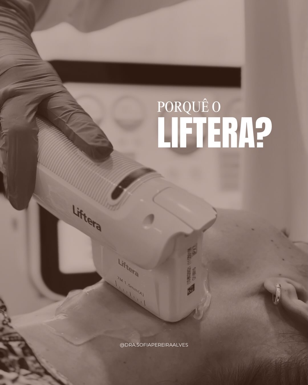 O 𝙇𝙞𝙛𝙩𝙚𝙧𝙖 &eacute; um ᴜʟᴛʀᴀꜱꜱᴏᴍ ᴍɪᴄʀᴏꜰᴏᴄᴀᴅᴏ (ʜɪꜰᴜ) de &uacute;ltima gera&ccedil;&atilde;o que estimula a produ&ccedil;&atilde;o natural de colag&eacute;nio, promovendo um efeito de &ldquo;lifting&rdquo; facial e uma melhoria da firmeza da pele