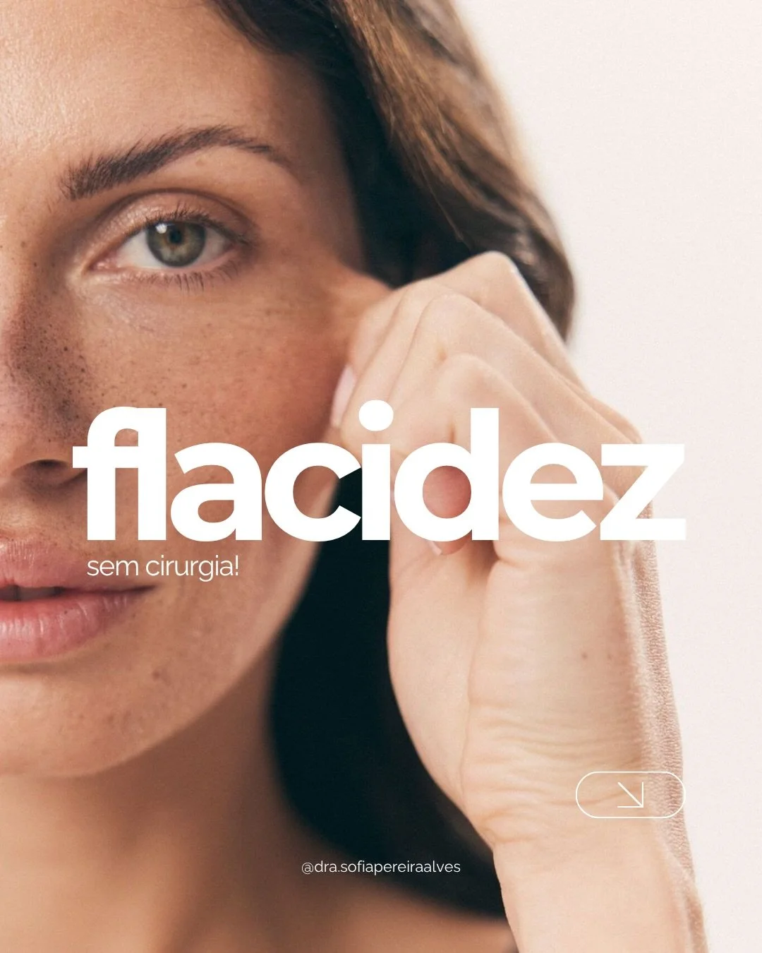 A flacidez &eacute; uma queixa cada vez mais frequente na minha consulta!

Mas, a boa not&iacute;cia &eacute; que hoje em dia j&aacute; conseguimos tratar a flacidez de forma muito eficaz, sem cirurgia, atrav&eacute;s da combina&ccedil;&atilde;o de t