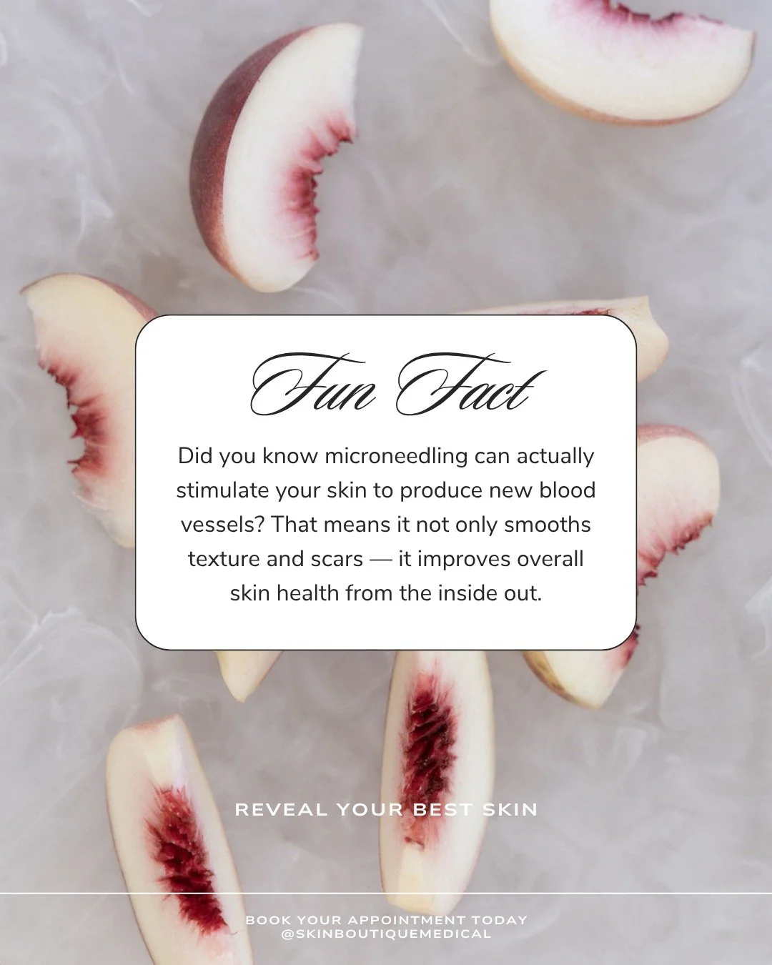 Wait... microneedling does what? 🤯🩸

Most people know microneedling as the "collagen queen," but did you know it actually triggers your skin to grow new blood vessels? This process is called angiogenesis, and it&rsquo;s a total game-chang