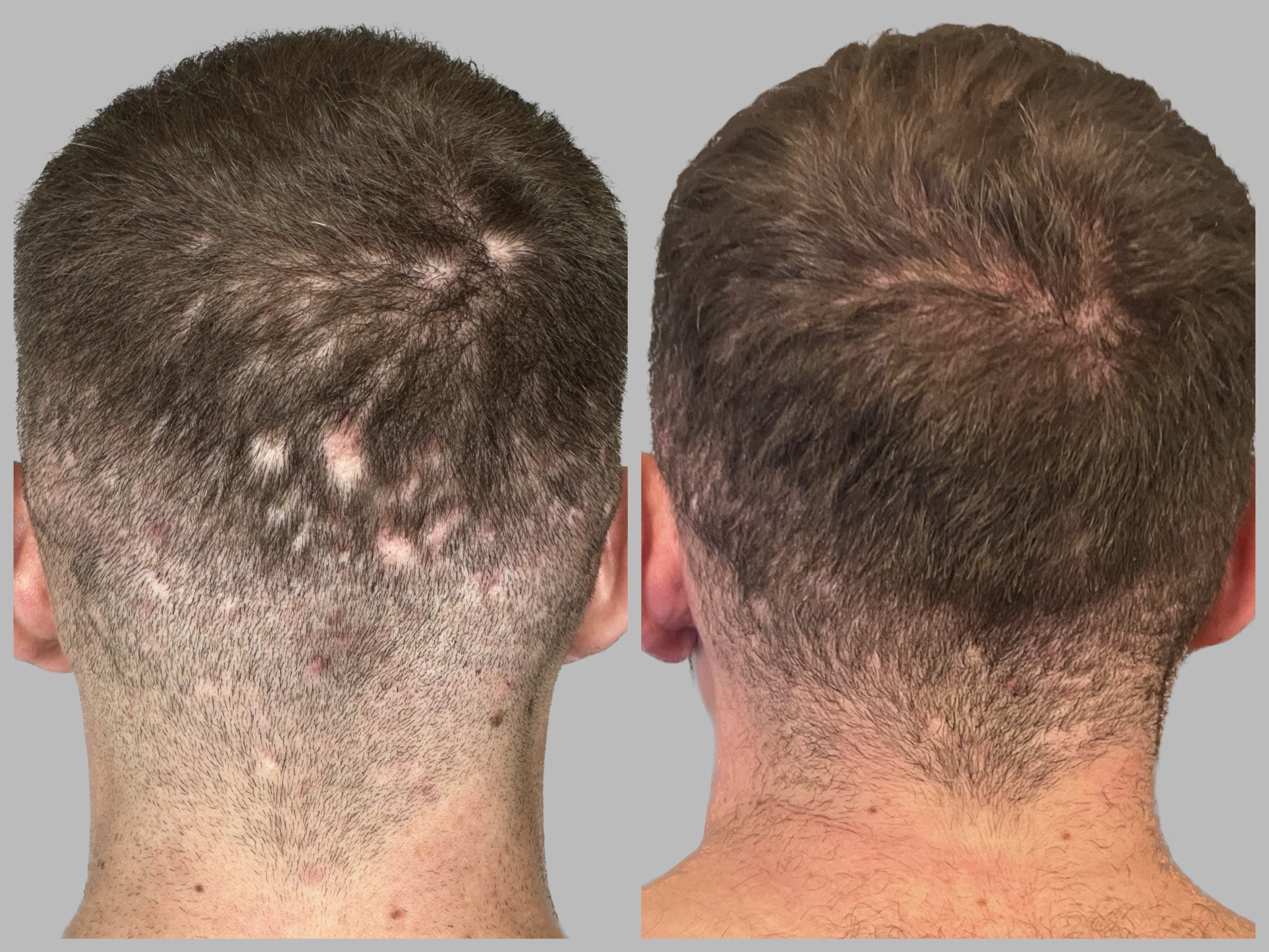 incollage_save 2.JPG