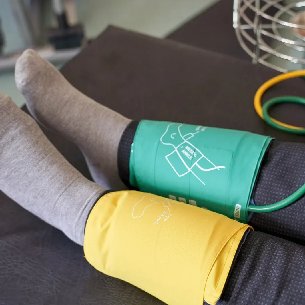 Ankle/Brachial Indices (ABI): Assessing Circulation Health in Limbs