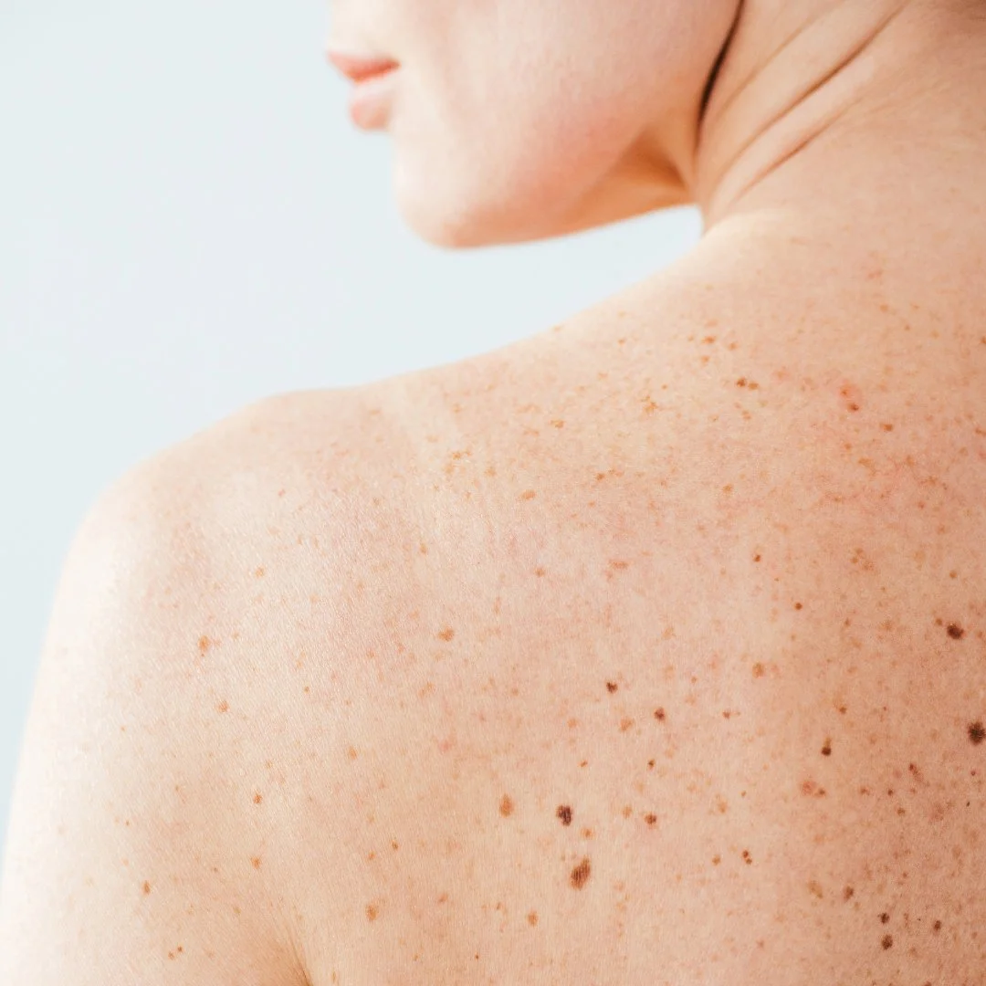 bare sholder with natural skin