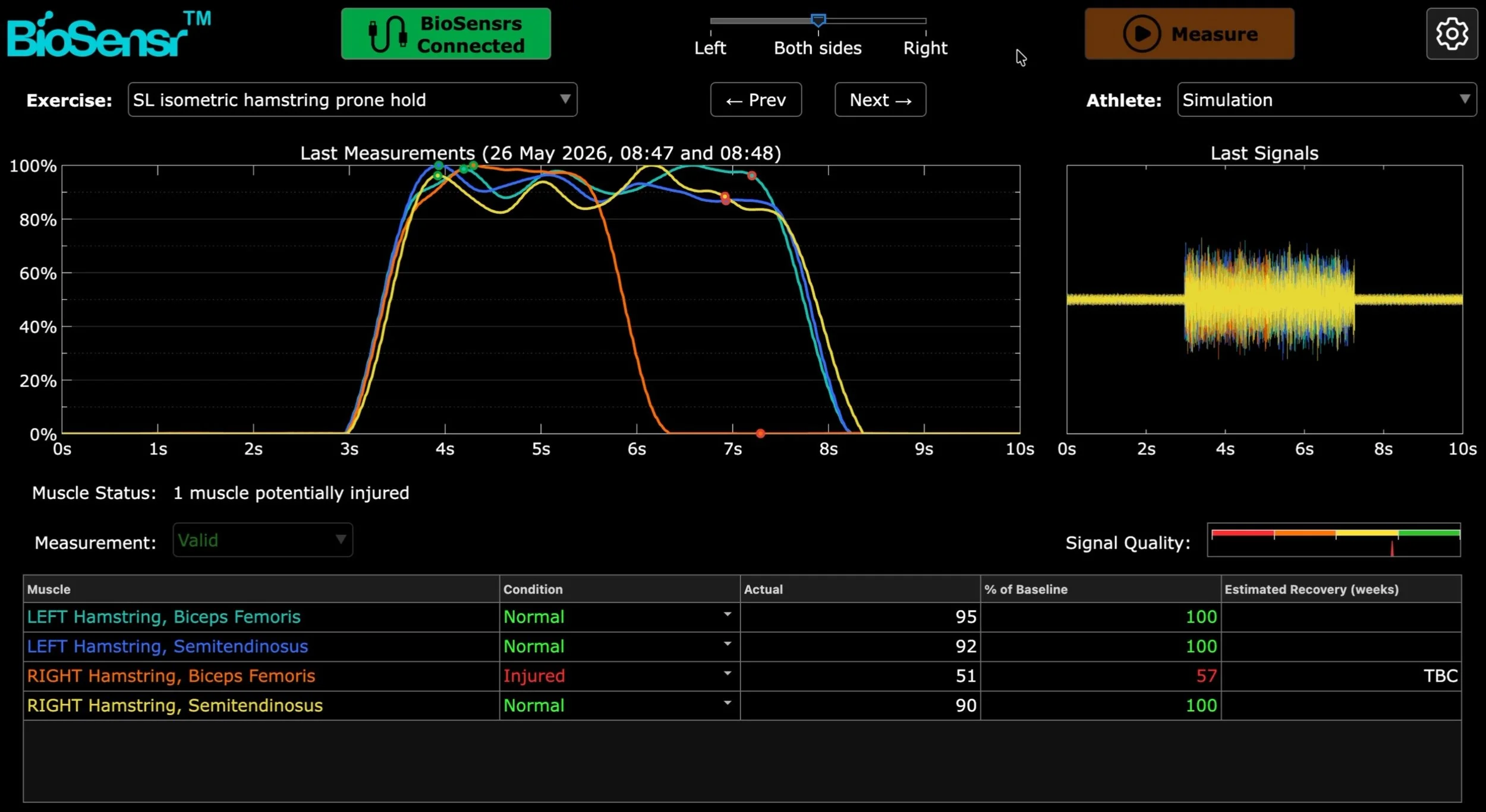 BioSensr V4.5.1_Still.JPG