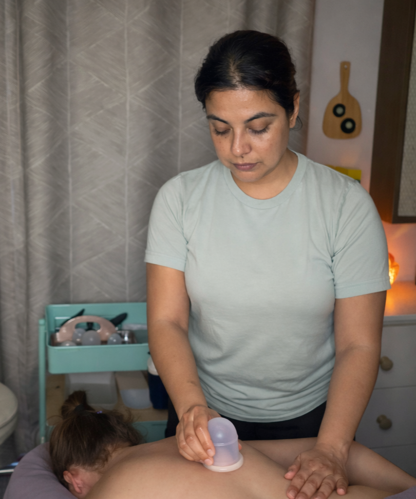 Cupping for pain relief in Newport Beach