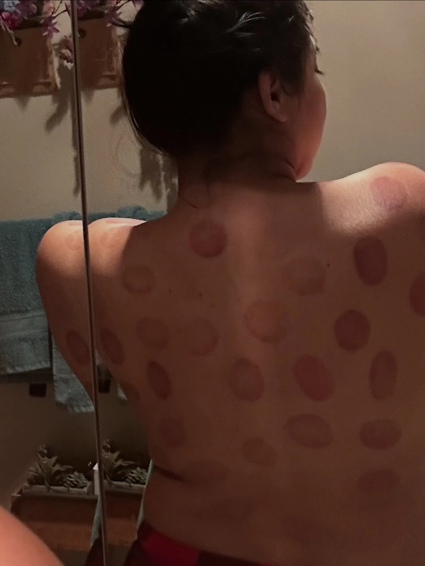 Yes, those are cupping marks 👀
I love adding cupping to my sessions because I know it works. It&rsquo;s my favorite thing that keeps my low back happy, releases my neck and shoulders before they get too tight, and even helps with my jaw tension from