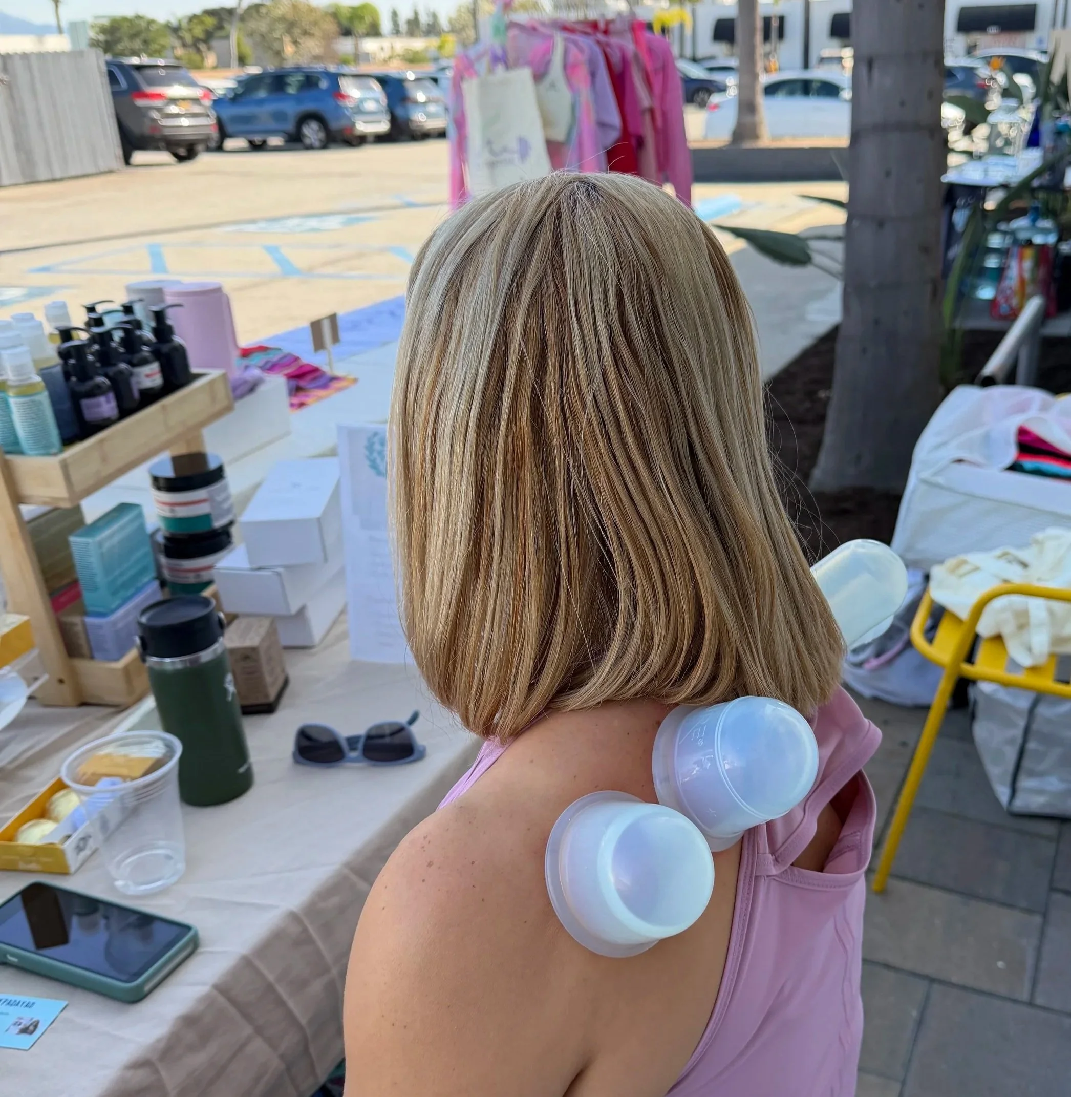 Cupping for neck and shoulder pain newport beach