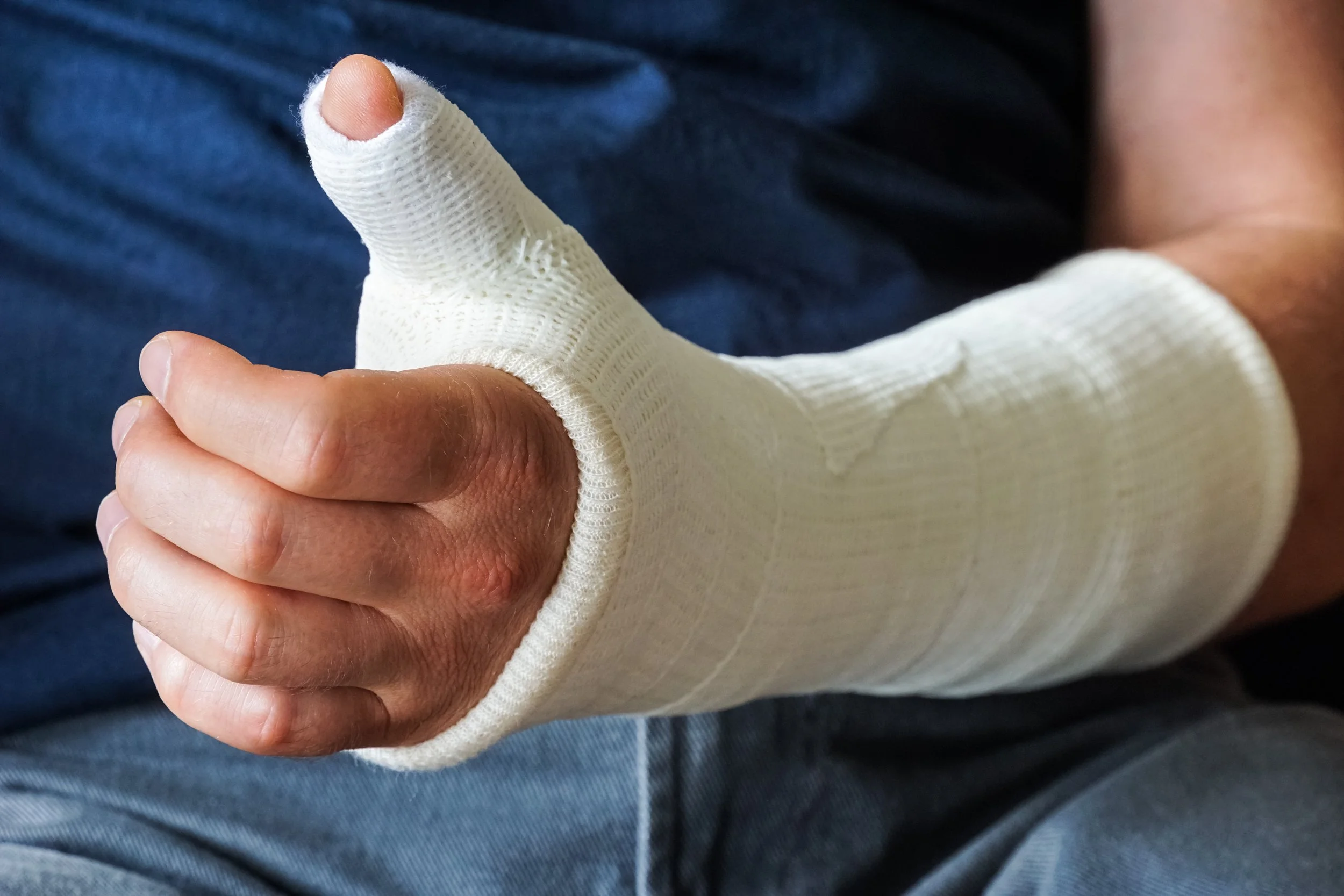 Navigating Hand Surgery Recovery: A Guide to Rehabilitation and Self-Care
