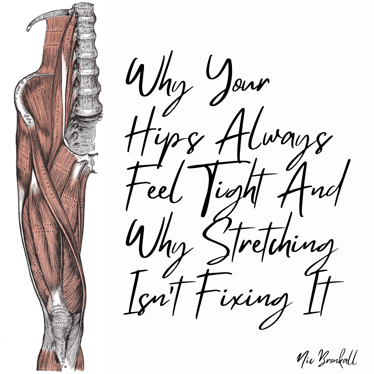 Why Your Hips Always Feel Tight And Why Stretching Isn’t Fixing It