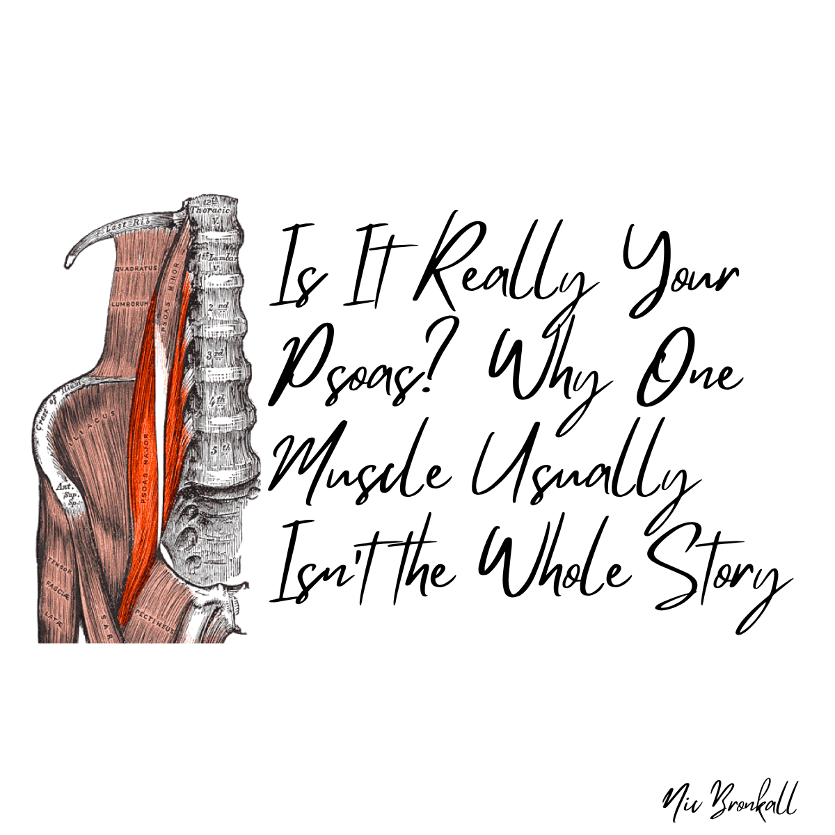 Is It Really Your Psoas? Why One Muscle Usually Isn’t the Whole Story