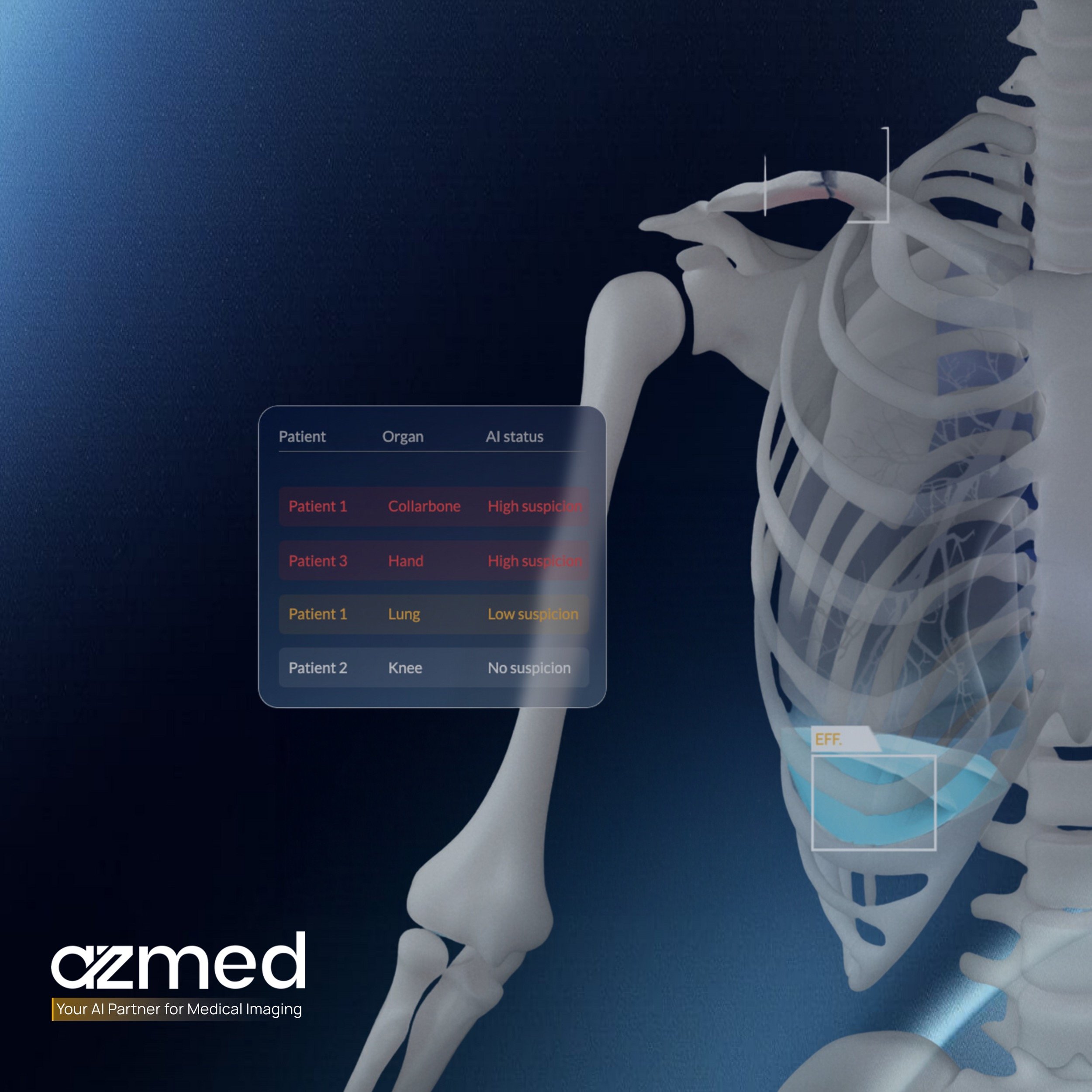 Logo des Unternehmens azmed mit einer Skelettstruktur im Hintergrund, einer weißen menschlichen Anatomie und einem blauen Hintergrund sowie dem Text „Your AI Partner for Medical Imaging“.
