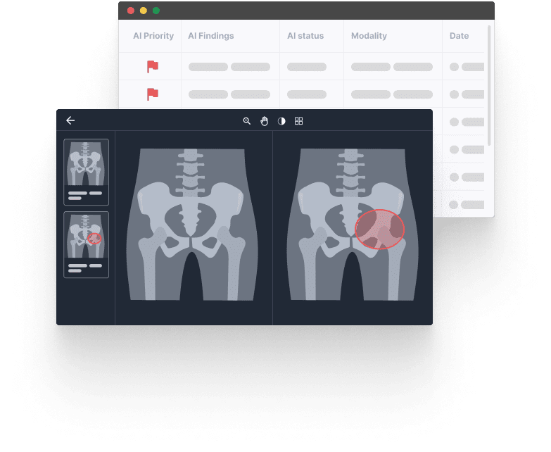 Maximize AI Solutions for Optimal Radiology Performance — intellimed