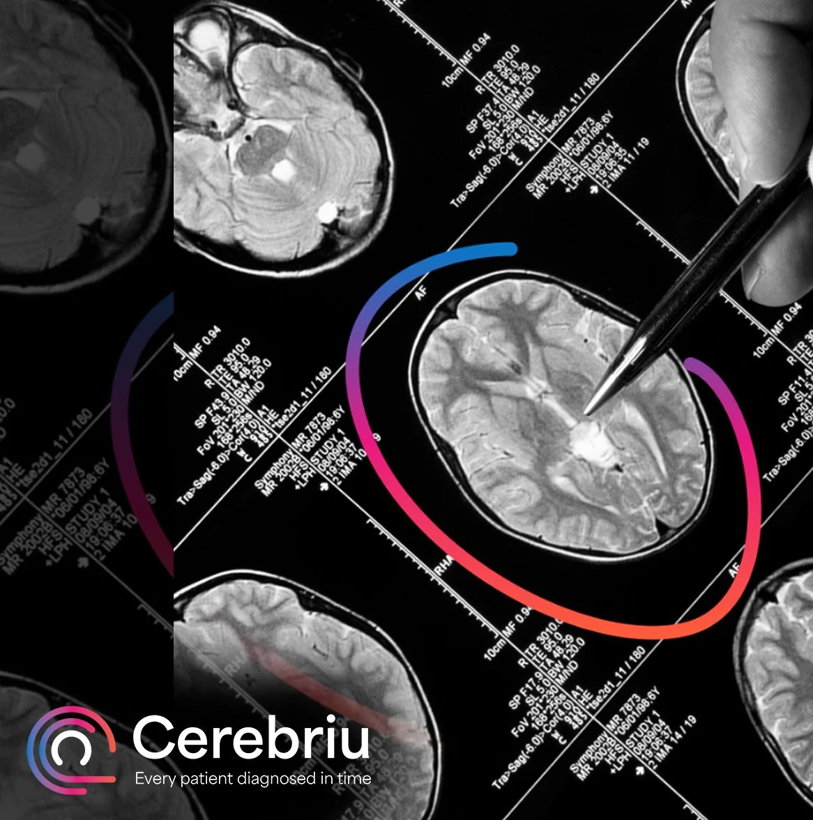 MRT-Aufnahmen des menschlichen Gehirns, auf denen ein Marker oder ein Stift auf einen bestimmten Bereich zeigt, zusammen mit medizinischen Daten und technischen Details sowie dem Cerebriu-Logo und dem Slogan „Every patient diagnosed in time“