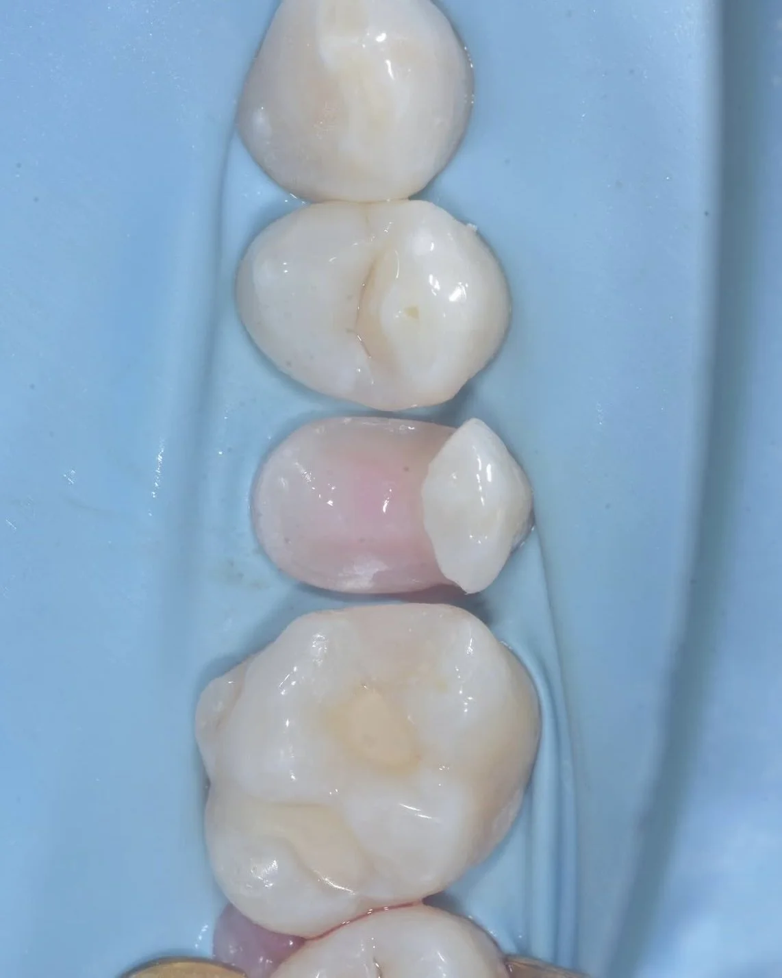 Central stop zone case Davey Alleman 7.jpg