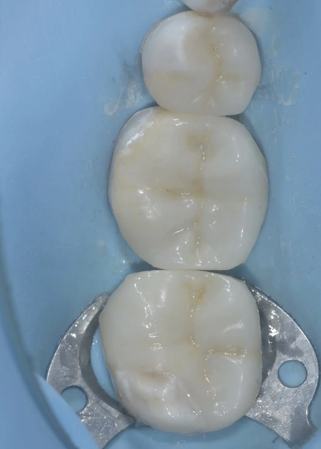 What is the biorim case 10.jpg